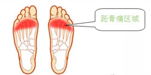 高掌远跖 近义词
