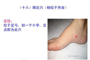 平衡针灸真人穴位演示,都是干货,值得收藏