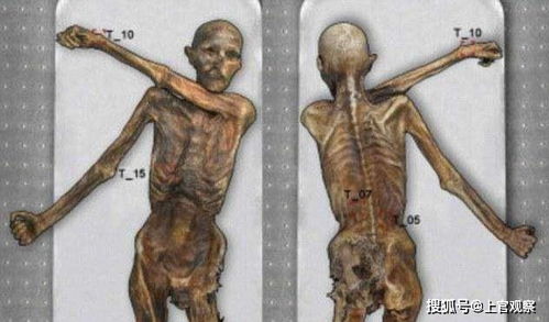 世界上现存最古老的古尸 冰人奥茨冰封5300年不腐