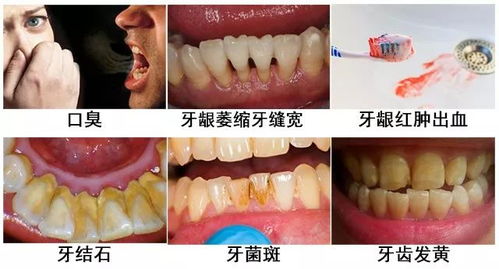 以牙还牙是什么意思?成语出处及详细词语解释