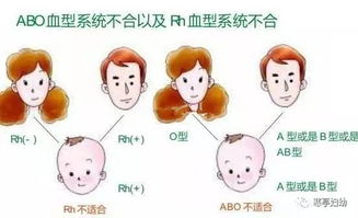 新生儿溶血是什么意思,严重吗、怎么治疗，新生儿溶血是什么意思哪类血型出现