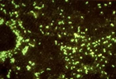 真菌和细菌是原核生物吗，纳米细菌是原核生物吗