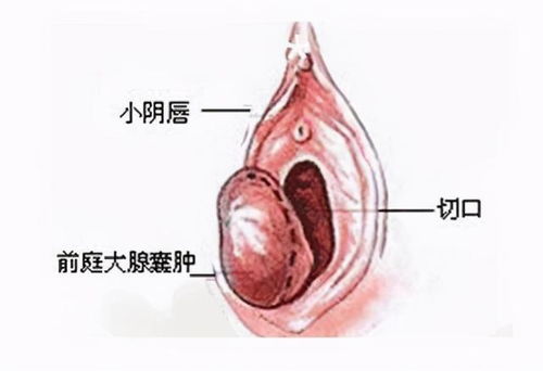 阴字的意思