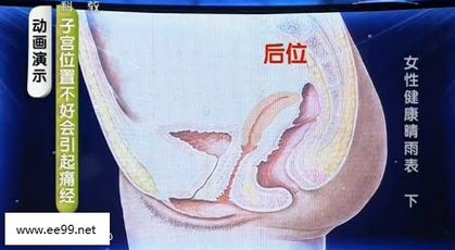 子宫在什么位置图