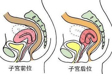 18岁幼稚子宫，子宫在腹部的位置图