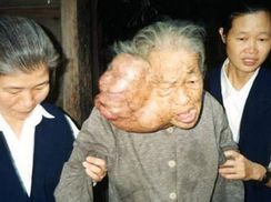 人面臁是什么