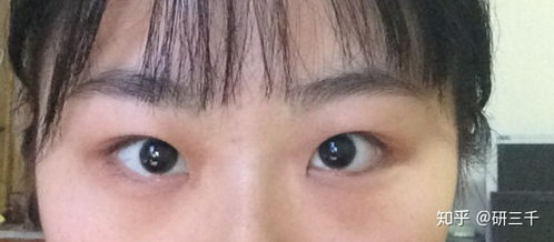 高低眼怎么改善，高低眼面相是好是坏