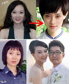 如何判断自己是不是高低眼