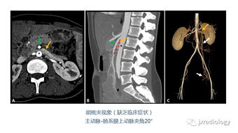 肚子用英语怎么说