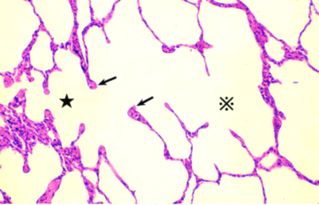 alveolar ridge，alveolar ventilation