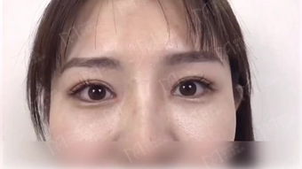 左眼跳是什么预兆?