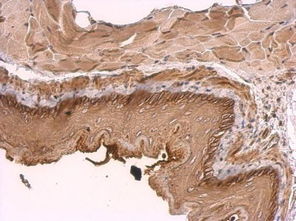 cytosol翻译，cytosolic DNA