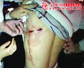 梦见腹部被捅了一刀里面的肠子都出来了，梦见腹部被捅了一刀流血不止