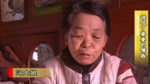 婆婆嘴是什么意思，婆婆嘴怎么改善