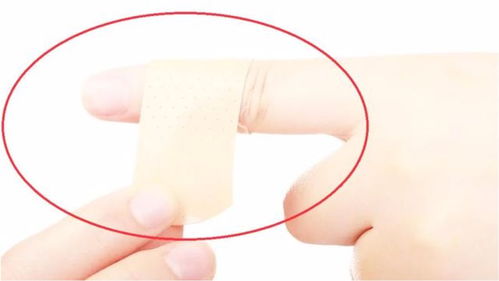 创口是什么意思
