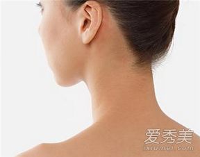 怎样消除颈上的皱纹