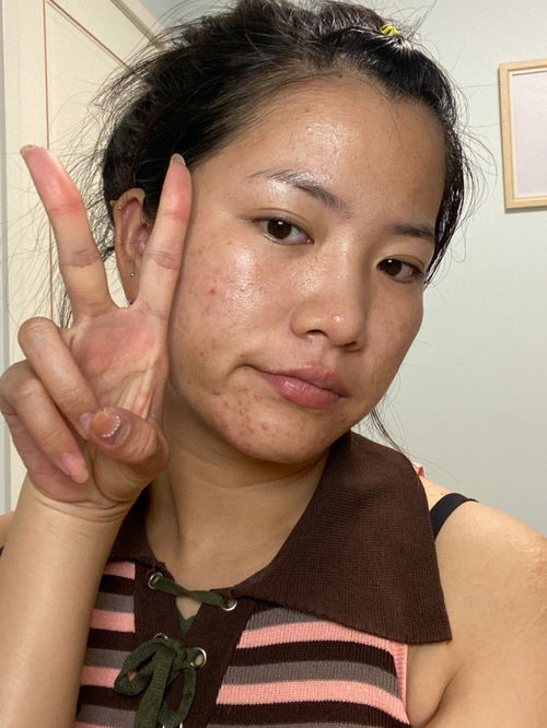 贴脸的解释贴脸的解释是什么