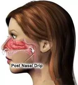 nasal congestion，nasals