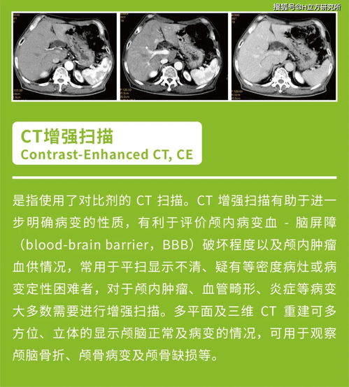 CT的全写是什么?