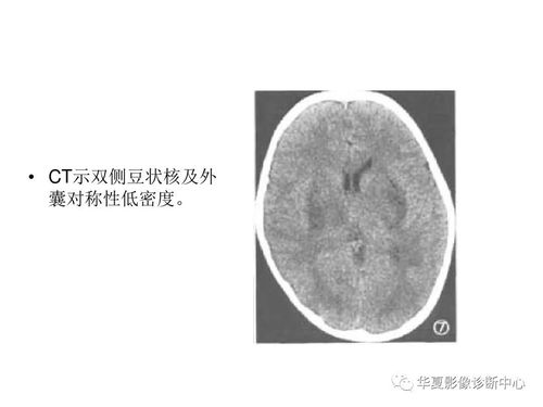 基底是什么意思