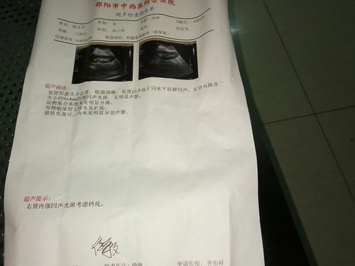 鸭的偏旁是什么，甲的偏旁有什么字