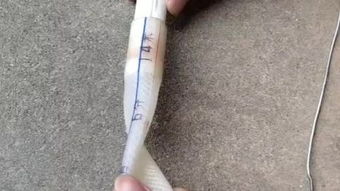 结实手术多少钱，结实耐用的拉杆箱推荐