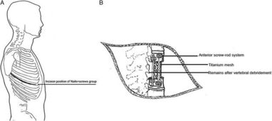 spinal shock，spinal muscular atrophy