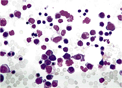 anemia是什么意思，Anemias