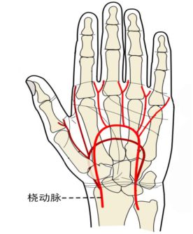 桡动脉破裂能坚持多久，桡动脉跳动肉眼可见