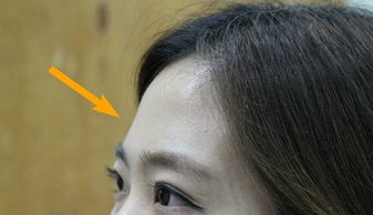 脑门和额头有什么区别?
