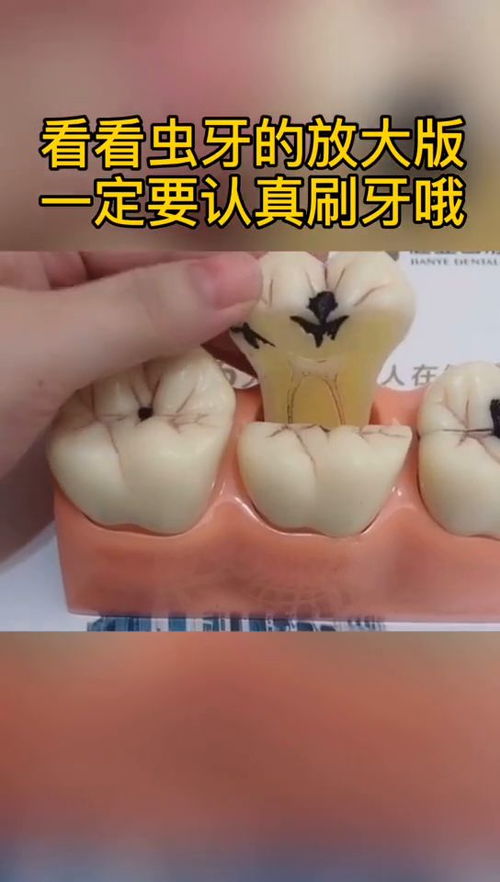 牙虫图片放大镜，蚜虫图片大全 成虫