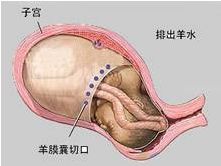 羊膜是由什么发育来的