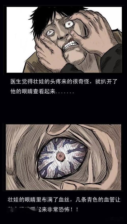 撞客的症状有哪些，撞客的人有什么症状