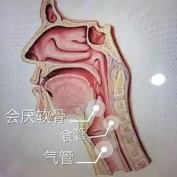 会厌新生物是什么意思