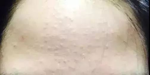 屏障是什么意思
