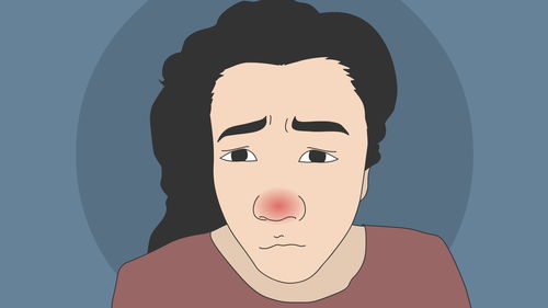 成语嗤之以鼻的意思，嗤之以鼻意思是什么