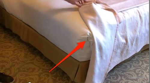 bedbugs，bedbugs bite