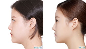 forehead是什么意思，forehead翻译