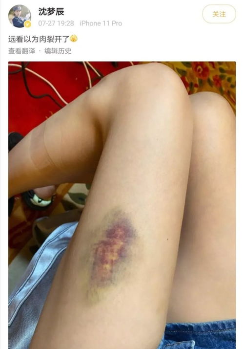 大腿照片多少钱，男孩大腿照片