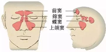 副鼻窦炎和鼻窦炎有什么区别，孩子副鼻窦炎是什么意思