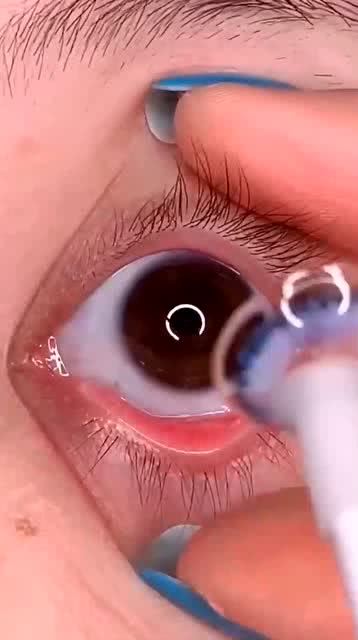 眼珠子斜了怎么办，眼珠子往外突出怎么回事