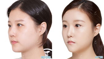 surgery是什么意思