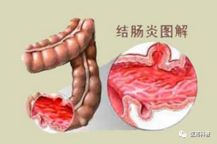 醒脾是什么意思，醒脾开胃颗粒