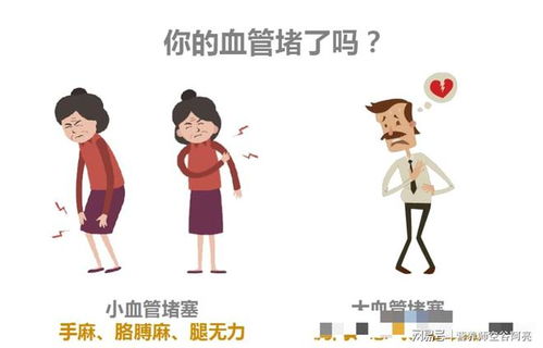 盯哨是什么意思