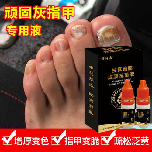 软甲膏，软甲壳类食物指什么