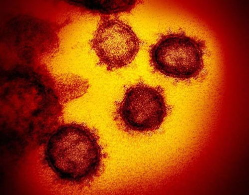infectious 神马意思
