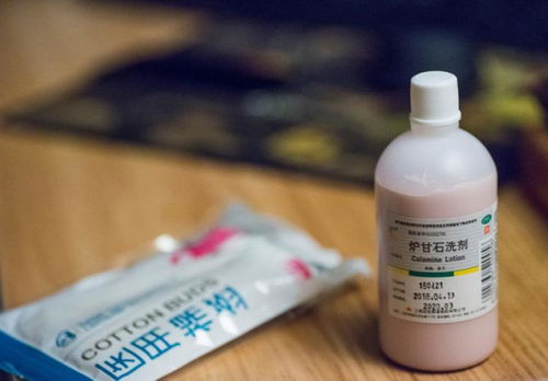 “炉甘石”的功效及其应用