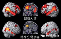 人体的氧气输送依靠血液中的什么?