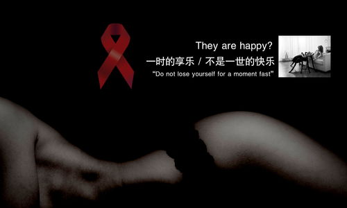 阿迪萨亚，adisson综合征