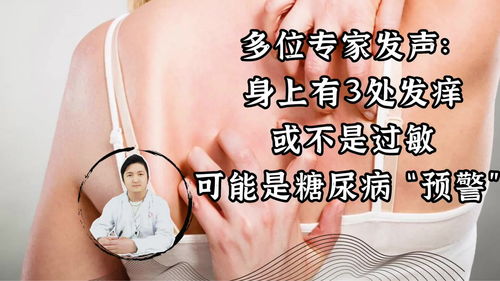 瘙痒怎么读